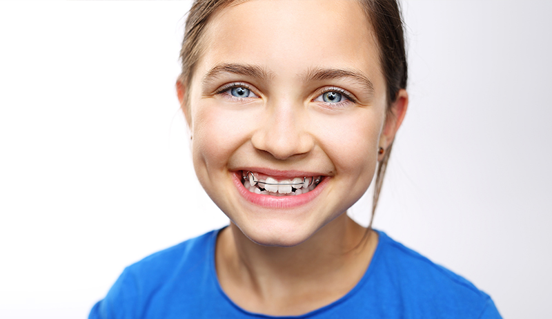 Girl wearing retainer